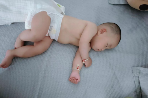 咸阳宝宝头上长痱子